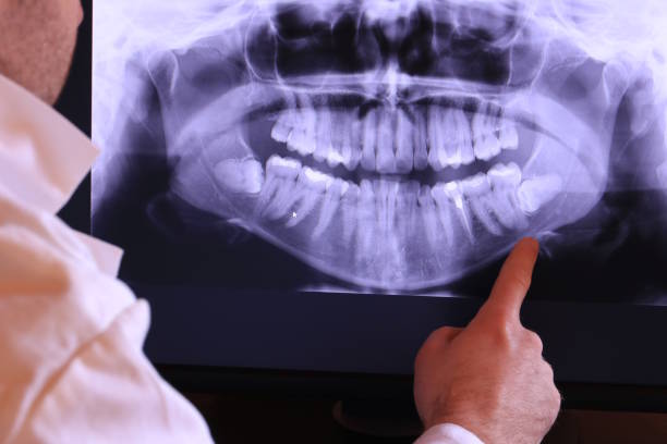 Best After-Hours Emergency Dentist in Fort Washakie, WY