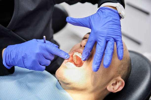 Best Emergency Tooth Extraction in Fort Washakie, WY