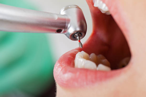 Best Emergency Treatment for Toothache in Fort Washakie, WY